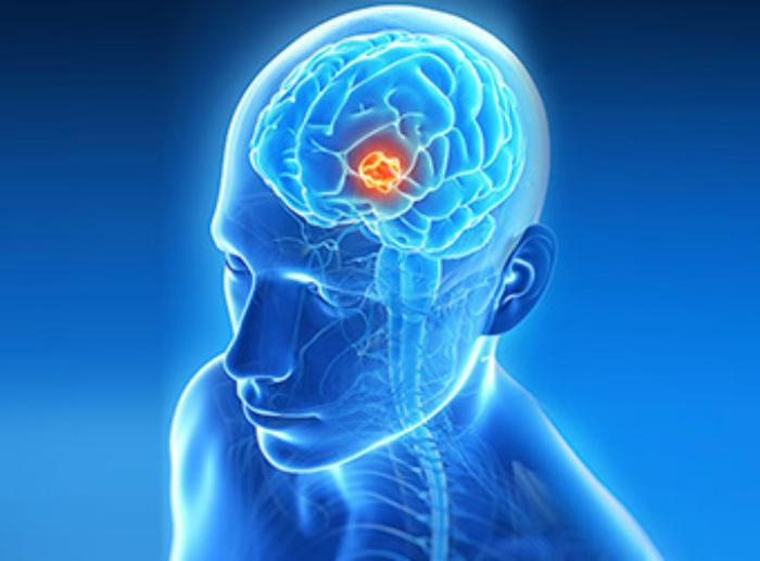 CriticalIllnessesNeedVitalPreparations