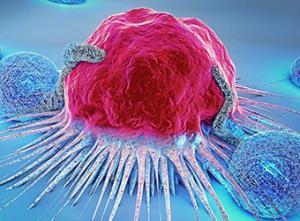 cancer_340x241.jpg